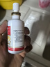 达克宁盐酸特比萘芬喷雾剂60ml脚气喷雾剂治脚气药止痒脱皮烂脚丫真菌感染自营脚臭脚气专用药乳软膏搽剂升级 实拍图