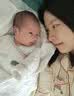 ASTACURE女性私密凝胶保养水润紧致私处紧缩粉嫩缩阴丹液医用护理产品10粒 实拍图