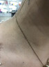 维A酸乳膏去疣体特新效期药扁平疣专用药去疣类药膏去脖子小肉粒颈部瘊子去尤瘊小肉粒去疣膏瘊子肉刺肉粒 1盒装【国药准字脱疣瘊】 瘊子去除国药准字药膏  放心购买 安心售后 实拍图