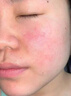 EDRI冻干粉修复屏障增厚角质层术后医修护褪红速效补水敏肌2盒装 实拍图