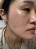 DR.MICKEY医用重组生长因子凝胶牛碱性成纤维细胞点痣喷人表皮祛疤痕膏修复 实拍图