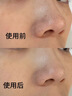 康佳（KONKA）黑头铲超声波吸黑头仪铲皮机去黑头清理神器导出导入美容仪黑头吸出器 实拍图