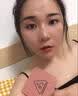 ASTACURE点痣点斑专用药脸部不留疤祛痣膏药水医用美容院专用官方正品去痣 实拍图