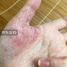 ELSIEDOCTOR湿疹药膏止痒去根皮肤瘙痒皮炎湿疹真菌感染汗疱疹肛门瘙痒 实拍图