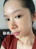 美白祛斑霜100%强效第1名淡化老年黄褐雀斑黑色素一夜消专用的药 2025新科技 男女医用【1支装】 实拍图