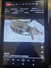 宏碁（acer）优跃FUN A310系列平板电脑pad 10.1吋高清全面屏4G插卡全网通话低蓝光护眼娱乐8核6G+128G灰 实拍图