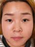 川廿制药熊果苷乳膏精华液去斑黑色素医用脸部改善暗沉男女士搭烟酰胺凝胶 实拍图
