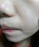 维A酸乳膏去疣体特新效期药扁平疣专用药去疣类药膏去脖子小肉粒颈部瘊子去尤瘊小肉粒去疣膏瘊子肉刺肉粒 1盒装【国药准字脱疣瘊】 瘊子去除国药准字药膏  放心购买 安心售后 实拍图