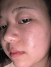 华美科医用湿敷水修复皮肤屏障受损修护爽肤补水保湿收缩毛孔精华液1瓶 实拍图