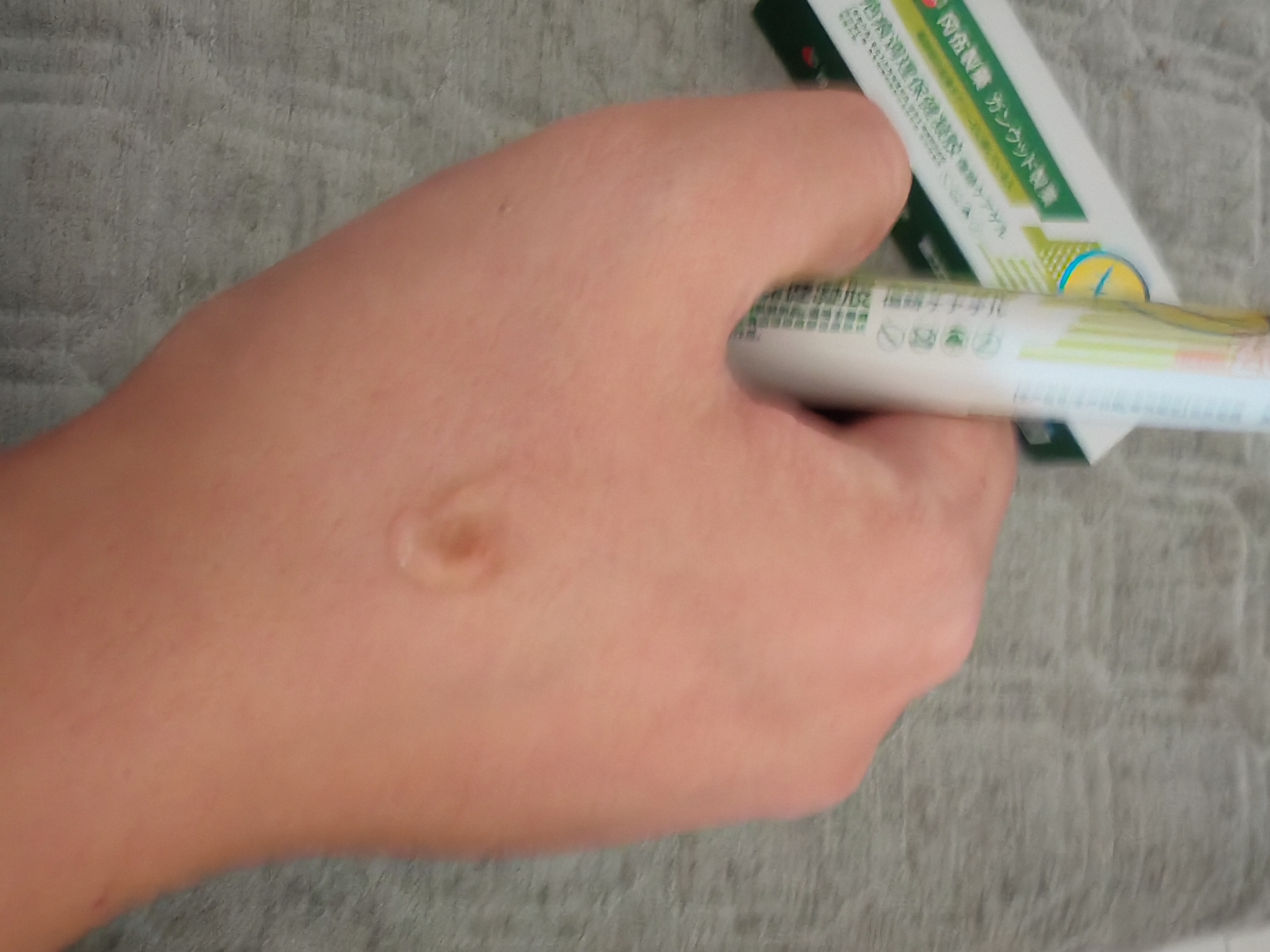 冈伍制药祛疤膏祛疤痕修复凝胶中药除疤剖腹产手术烧烫伤去痘印淡疤20g/支 实拍图