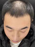 维特丝防脱洗发水生姜固发侧柏叶育控油去屑持久蓬松洗头膏露男女士专用 实拍图