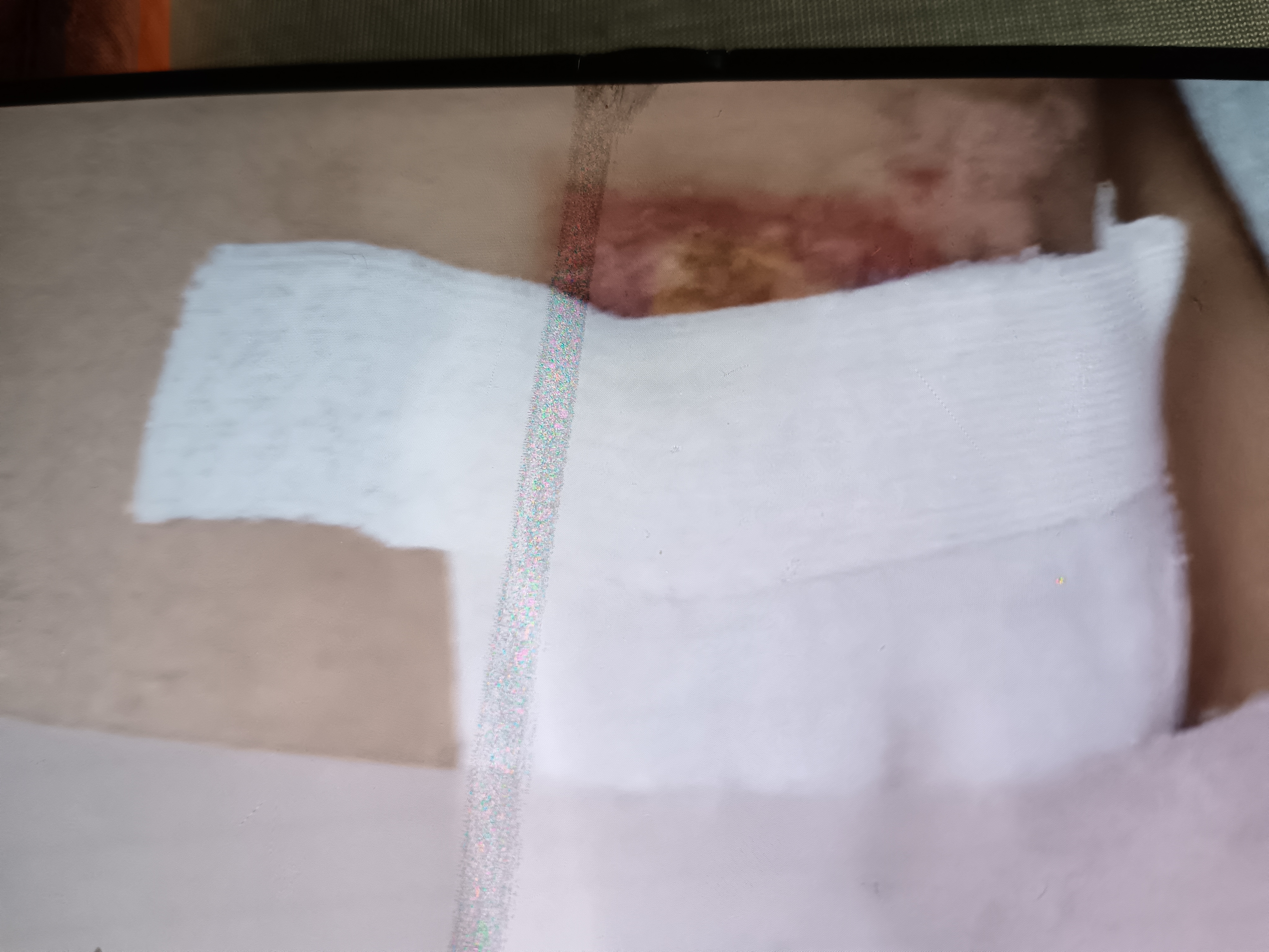 振德（ZHENDE）凡士林医用油布纱布块伤口敷料15片烧烫伤造瘘粗纱布5*10cm 实拍图