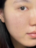 儒意（RUYI）水杨酸果酸次抛精华液补水收缩毛孔粗大祛痘修复淡化痘印痘坑男女 实拍图
