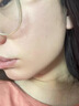 维特丝壬二酸15%凝胶祛痘药膏祛痘印淡痘印水杨酸胶态硫烟酰胺乳青春期 实拍图