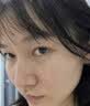 医用精华液械字号收缩毛孔粗大修复细致去黑头粉刺闭口男士女士祛痘印黑色素沉淀控油淡化痘印痘坑透明质酸钠 实拍图