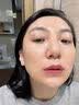 东洋之花玻尿酸原液精华液抗皱紧致精华提拉男女士衰老淡化细纹法令纹 实拍图