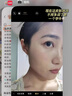 白云山377烟酰胺面霜美白祛斑霜淡化黑色素去老黄斑雀斑抗氧化保湿55g 实拍图