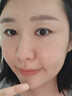 丽芙阿达帕林凝胶0.1%*9克/盒医用正品维a酸乳膏改善毛孔粗大去黑头祛痘痤疮专用青少年修复淡化痘印药膏 实拍图