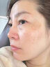 维特丝377水乳液精华美白祛斑补水保湿男女士护肤品抗皱紧致抗衰老舒缓 实拍图