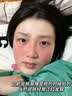 透真修复冻干粉精华液蓝铜胜肽多肽术晒后修护红血丝角质屏障敏肌泛红 实拍图