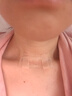 施乐辉疤痕贴医用剖腹产增生烧烫伤医美自粘性硅酮胶片敷料 12*6cm 实拍图