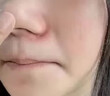 御医匠鼻炎鼻贴过敏性鼻炎鼻窦炎贴鼻塞鼻痒治根穴位贴儿童成人专用膏药 1盒装 实拍图
