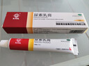 马应龙尿素乳膏10%20g/盒 尿素软膏尿素霜医用尿素乳膏手脚干裂干燥手足皲裂脚后跟干裂膏角化型脚气 实拍图