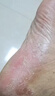 DR.DOLLME 朵美博仕医用碘伏消毒液泡i脚去i脚气专用止抑菌痒脚除臭汗气脱皮真菌感染 2瓶见效装【足臭脚庠 只需一泡】 碘伏消毒液医用碘伏泡i脚 实拍图