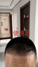 【第二代米诺地尔】蔓迪生发泡沫60g*2（敏皮专属 温和不油腻）5%男女士快速防脱育发米洛原液搽剂酊曼迪 实拍图