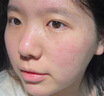 透真维生素b5精华液修护屏障受损敏感泛红晒后修复积雪草补水保湿提亮 实拍图