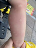 沃森博士紫草膏婴幼儿防蚊虫叮咬止痒消肿膏药0岁宝宝消包专用舒缓止痒膏 实拍图