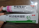 丽芙甲硝唑凝胶30g+阿达帕林凝胶35g甲硝锉凝胶祛痘印修复淡化痘印痘坑修复药膏 实拍图