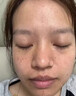 维A酸乳膏去疣体特新效期药扁平疣专用药去疣类药膏去脖子小肉粒颈部瘊子去尤瘊小肉粒去疣膏瘊子肉刺肉粒 1盒装【国药准字脱疣瘊】 瘊子去除国药准字药膏  放心购买 安心售后 实拍图