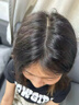 DR.SOKK生发液激活毛囊增发密发长发剂育发液固发液防脱发严重男女士专用 实拍图