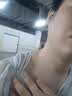 维A酸乳膏去疣体特新效期药扁平疣专用药去疣类药膏去脖子小肉粒颈部瘊子去尤瘊小肉粒去疣膏瘊子肉刺肉粒 1盒装【国药准字脱疣瘊】 瘊子去除国药准字药膏  放心购买 安心售后 实拍图