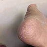 维特丝马油脚裂膏脚后跟干裂开裂修复防裂膏手足裂皮肤皲裂愈合冻疮膏 实拍图
