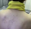 [拜都帮]曲安奈德益康唑乳膏 汗斑花斑癣专用药汗斑专用药(发货特效)真菌感染皮肤用药皮肤白斑汗斑净 15g 3支装 【大片白斑黄斑红斑】 实拍图