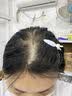 Smeal司缪养发丸补铁小黑丸生物素复合维生素bc角蛋白铁剂补发发肤甲 【发肤甲全周期】 16粒*6盒 补铁丸 实拍图