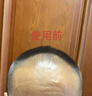 【第二代米诺地尔】蔓迪生发泡沫60g*2（敏皮专属 温和不油腻）5%男女士快速防脱育发米洛原液搽剂酊曼迪 实拍图