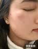 井次制药去痣点痣膏水脸部痦子扁平疣瘊子面部黑痣男女士通用试用装 实拍图