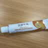 保益宁尿素乳膏20%*10g盒*3尿素软膏维生素e医用尿素乳膏手脚后跟干裂开裂皮肤干燥手足皲裂去鸡皮肤角化型 实拍图