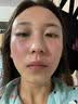 维特丝芦荟胶补水保湿晒后修复凝胶面霜祛痘印收缩毛孔烟酰胺男女士 实拍图