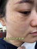 白云山377烟酰胺面霜美白祛斑霜淡化黑色素去老黄斑雀斑抗氧化保湿55g 实拍图