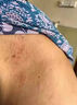 北京协和医学院湿疹药膏十大牌子皮肤瘙痒皮炎湿疹真菌感染止痒膏抑菌去顽固湿毒 特效升级【1盒】北京协和出品 止痒抑菌皮肤瘙痒去顽固湿毒进口 实拍图