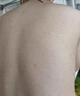 本安制药（BENAN PHARMACEUTICAL）荨麻疹专用膏皮肤瘙痒过敏止痒增强免疫力抑菌皮炎湿疹真菌1盒 实拍图