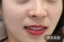 井次制药去痣点痣膏水脸部痦子扁平疣瘊子面部黑痣男女士通用试用装 实拍图