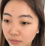 维A酸乳膏去疣体特新效期药扁平疣专用药去疣类药膏去脖子小肉粒颈部瘊子去尤瘊小肉粒去疣膏瘊子肉刺肉粒 1盒装【国药准字脱疣瘊】 瘊子去除国药准字药膏  放心购买 安心售后 实拍图