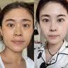 OHBT面膜美白淡斑补水保湿男女士熬夜舒缓抗皱紧致去黄气暗沉提亮肤色 实拍图