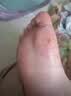 北同世家脚气喷雾剂药止痒脱皮烂脚丫真菌感染根冶脚气臭脚除臭杀菌抑菌 实拍图