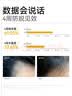 长发小寨【非遗】固发防脱洗发水400ml+护发素50ml淘米水强韧防断改善掉发 实拍图
